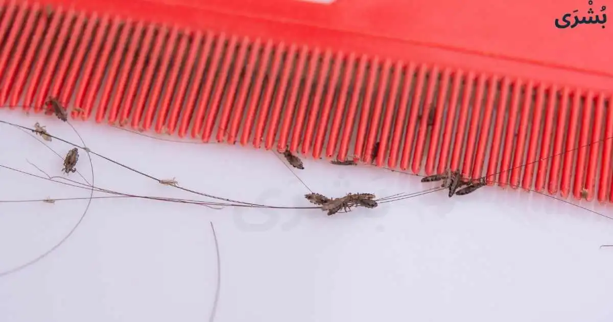 تفسير رؤية القمل في المنام